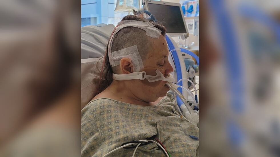 Maggie Brooks didn’t know she had been living with an intracranial aneurysm before it ruptured...