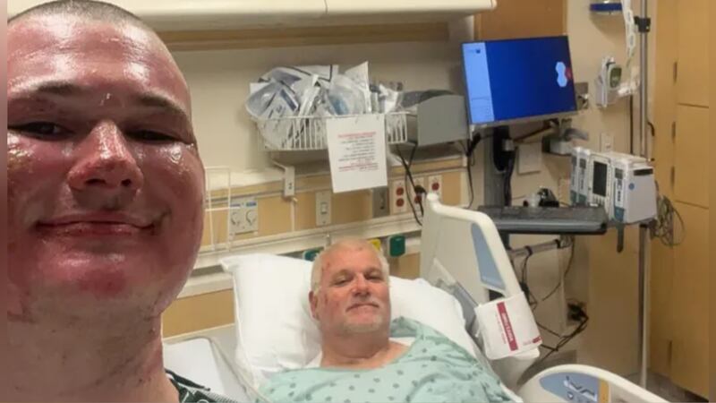 Darrell and Reese Tucker survived catching fire after the car they were working on exploded.