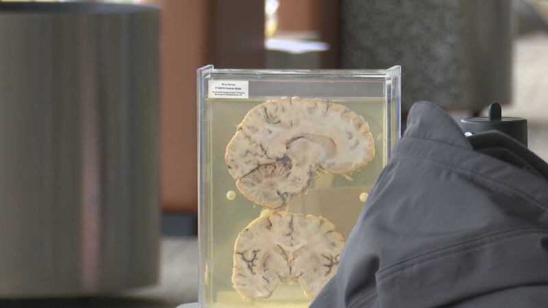 Brain sample on display at University of Alaska Anchorage during Brain Bee competition.