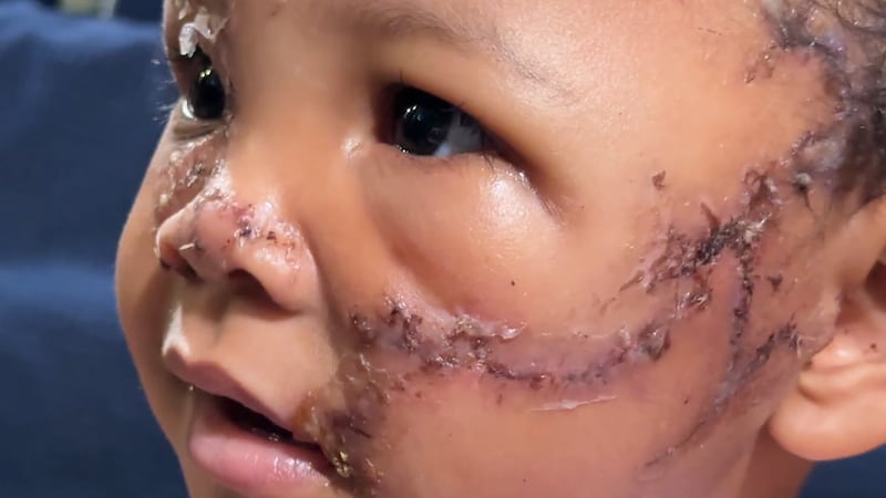 A two-year-old Las Vegas toddler was rushed to the hospital after a toddler was bit by an XL...