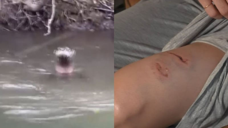 Fish and Game said otters have attacked people and pets in recent weeks in Anchorage.