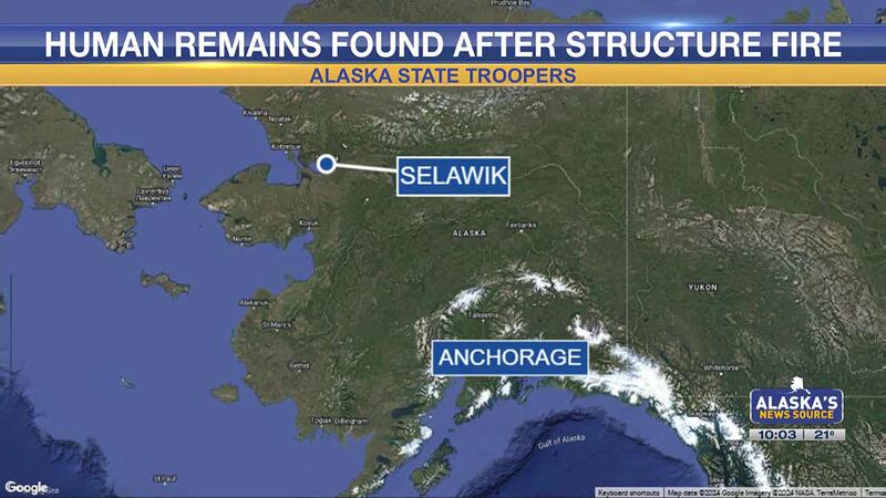 Human remains were found inside a Selawik home after a structure fire Saturday morning,...